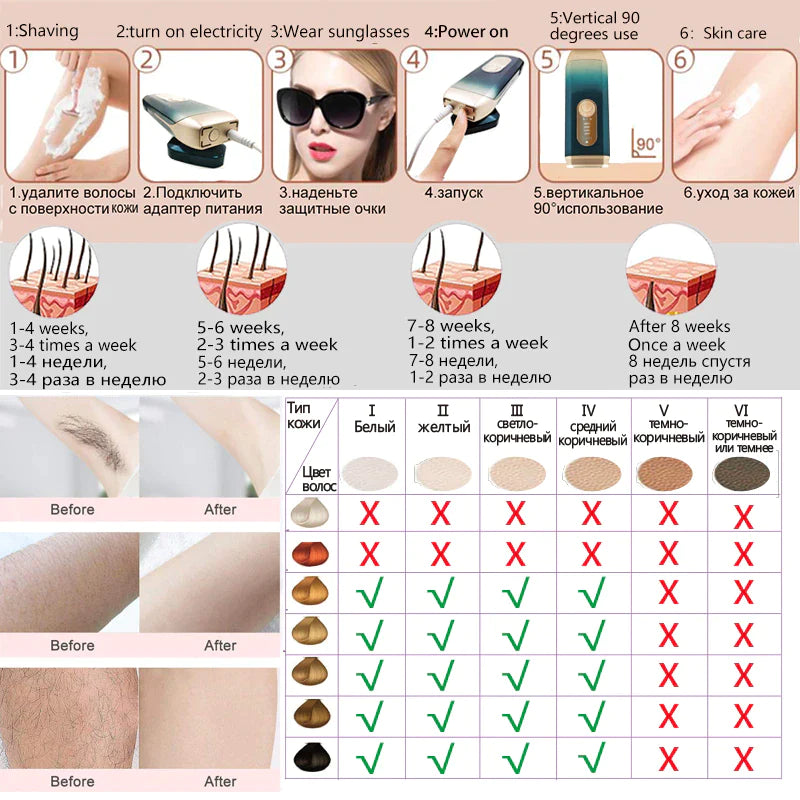 Laser Hair Removal Device Ice Cooling IPL Laser Epilator Home Use Depilador a Laser Laserowy for Women Laser Hair Removal
